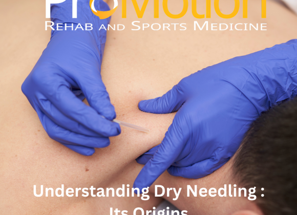 Dry Needling